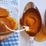 The Natural Wonder: Apple Cider Vinegar for Wart Removal