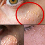 Doctors reveal eating bananas at night causes